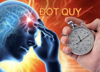 7 điều bạn có thể làm để ngăn ngừa đột quỵ