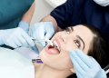 Đi nhổ răng có được bảo hiểm y tế chi trả?
